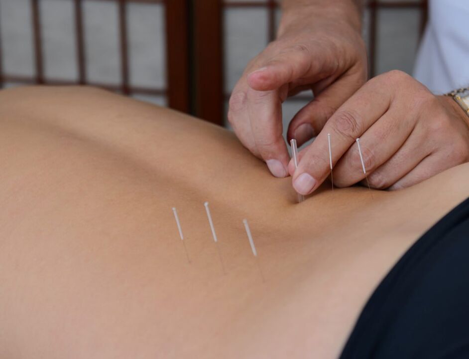 acupuncture alang sa prostatitis