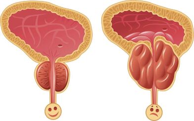 Himsog ug naghubag nga prostate sa lalaki