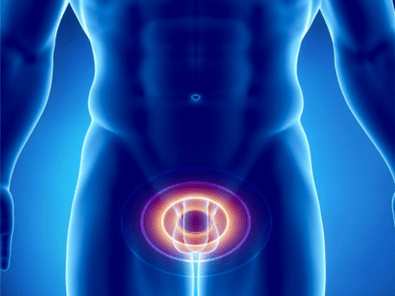 Prostatitis - panghubag sa prostate gland sa usa ka lalaki