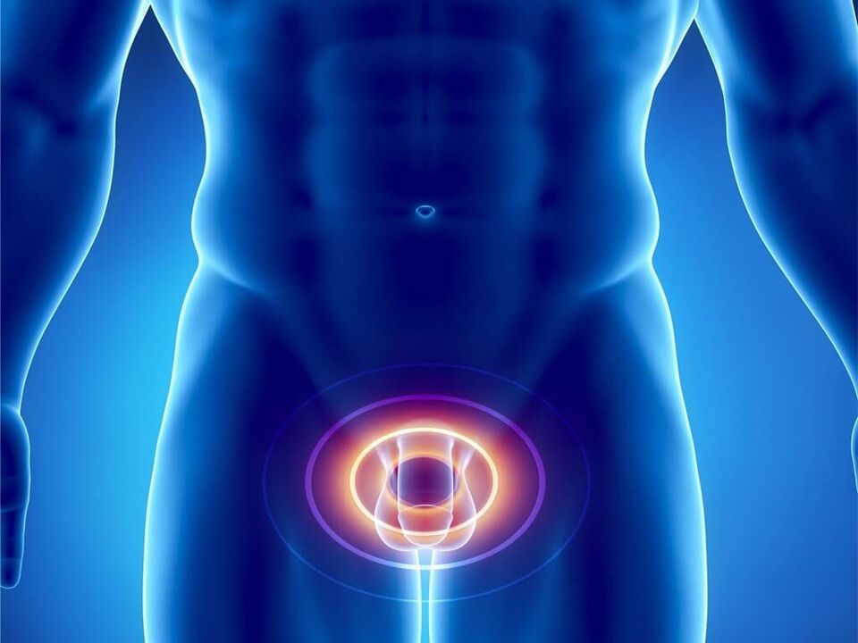 Sintomas sa prostatitis sa mga lalaki